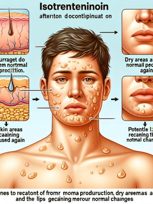 Cómo reacciona el cuerpo al dejar Isotretinoina